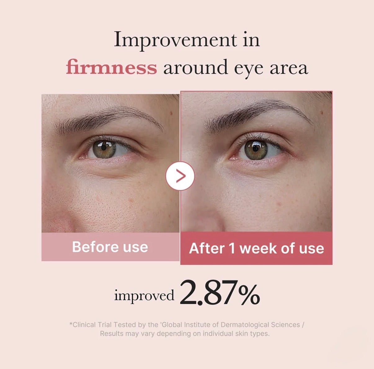 PDRN Pink Peptide Eye Cream