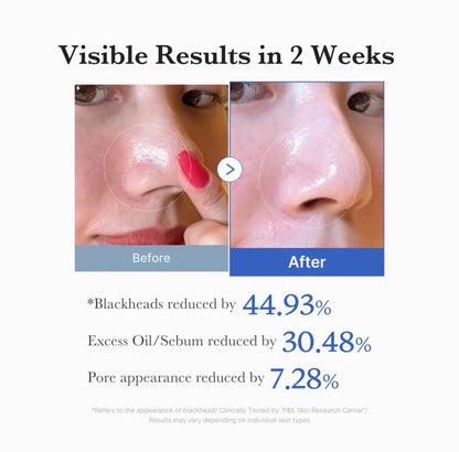 Zero Pore Pad 2.0