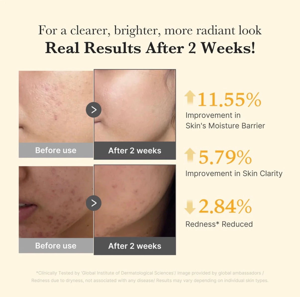 Kojic Acid Turmeric Niacinamide Serum